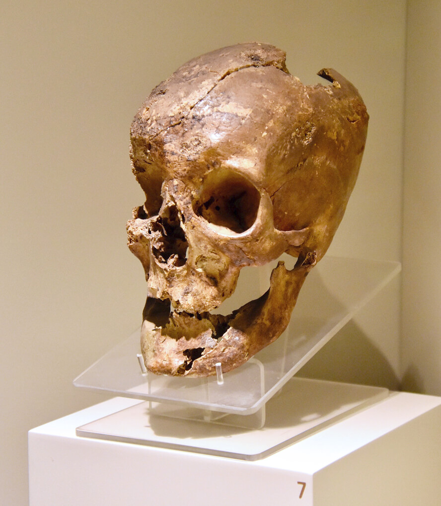 Skull of King Midas of Phrygia